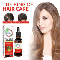 Aceite esencial suave pero hidratante para el cuero cabelludo para un cuidado del cabello grueso, fuerte, flexible, suave y hermoso - details 1