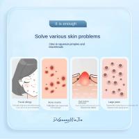 Suministros de salón, herramienta de belleza con mango cómodo, eliminador de espinillas, herramienta de eliminación de espinillas, limpiador de poros, agujas para imperfecciones de acné - details 4