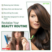 El romero nutre suavemente el cuero cabelludo, espesa, nutre, fortalece y solidifica el aceite esencial para el cuidado del cabello - details 6