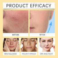 Mantequilla y miel nutre suavemente, hidrata por mucho tiempo, retiene el agua y calma el rostro. Cuidado hidratante de la piel. - details 8