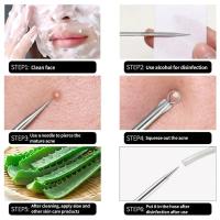 Set de Agujas para Acné Limpieza Facial de Acero Inoxidable con Doble Fin - details 1