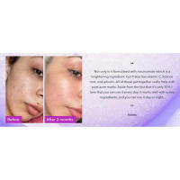 Good Molecules Niacinamide Brightening - Tónico facial con niacinamida, vitamina C arbutina para un tono uniforme y poros dilatados - details 4
