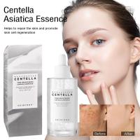 Skin1004 Madagascar Centella Asiatica ampolla suero Facial aceite hidratante cuidado de la piel para iluminar el cuidado de la cara cuidado de la piel - details 1