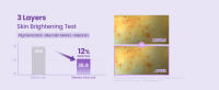 Skin Brightening Test