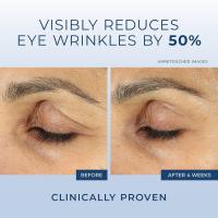 Hot RoC Retinol Correxion crema debajo de los ojos ojeras e hinchazón, crema diaria para arrugas, línea antienvejecimiento suavizante para el cuidado de la piel - details 4
