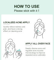 Crema Facial a base de hierbas para el acné, eliminación de marcas de espinillas, Control de aceite, crema hidratante para el rostro, cremas faciales suaves, productos para el cuidado de la piel JoyPretty - details 6