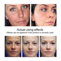 Crema Instantánea para Eliminar Arrugas Reafirmante Antiedad Blanqueador Hidratante - details 12