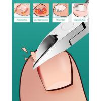 Cortaúñas profesionales para Uñas Gruesas o Incrustadas, Herramienta de Aseo Portátil Inoxidable con Doble cara - details 3