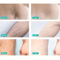 Novedad Sin Flaw Afeitadora Portátil Recargable para Mujeres Eliminadora de Vello Corporal sin Dolor para Cara y Ombligo Accesorio de Belleza - details 9