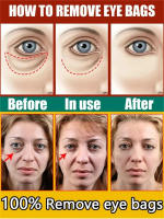 Crema de colágeno para ojos, elimina las bolsas de los ojos, antiojeras, hinchazón, Reduce las arrugas, humectante reafirmante, belleza, producto para el cuidado de la piel - details 0