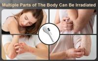Lámpara de Terapia UVB KTS para Tratamiento de Vitiligo 308NM Luz Ultravioleta de Banda Estrecha para Eczema y Psoriasis Herramienta de Cuidado de la Piel Corporal - details 1