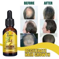 Serum de Crecimiento de Cabello Aceite Esencial de Jengibre para Regeneración Rápida - details 3