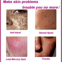 Crema Blanqueadora Astragalus Removedor de Manchas Dark Eyes Reparador de Melasma Hidratante - details 4
