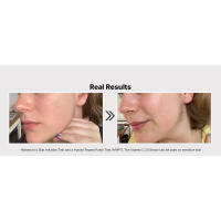 Suero facial hidratante ligero COSRX Pure C 23% con ácido hialurónico y vitamina E - details 1