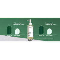 Anua Heartleaf Aceite limpiador de poros Removedor de puntos negros para belleza coreana 200 ml - details 11