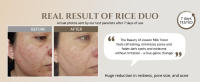 Tónico facial de arroz que repone el brillo, cuidado hidratante coreano para pieles grasas y mixtas - details 2