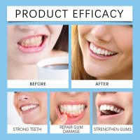 Enjuague bucal multiprotección para olores, limpieza de manchas dentales, frescura y cuidado bucal - details 8