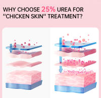 KP loción corporal blanqueadora, eliminador de piel de pollo, tratamiento de queratosis pilaris, crema hidratante de poros suave y áspero, crema corporal para el cuidado de la piel - details 4