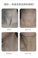 Tratamiento de Belleza para el Cuello Masajeador Facial Dispositivo de Introducción en Casa - details 3