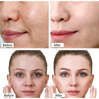 Retinol crema blanqueadora facial suero para ojos esencia facial antiarrugas reafirmante Lifting mejora las líneas brillo hidratación fina - details 4