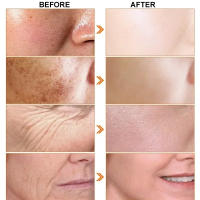 Crema de suero facial japonesa Sakura, eliminador de arrugas, antienvejecimiento, se desvanece, líneas finas, reafirmante, vitamina C, blanqueamiento, rejuvenecimiento, cuidado de la piel - details 1