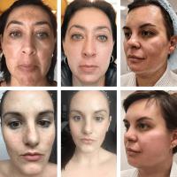 Crema iluminadora facial, niacinamida, Reduce el cloasma, melasma, melanina, desvanece las líneas finas, aclara la piel oscura, suero para el cuidado, crema iluminadora - details 0
