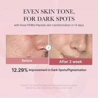 Medicube PDRN Toner de Peptida Rosa Calmante y Revitalizante para la Piel - details 1