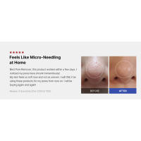 microneedle, Zero exosome shot, Lacto exosome, instant pore-tightening care, Pore Refining serum