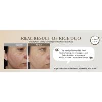 rice MASK