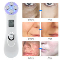 Masajeador Facial de radiofrecuencia, máquina de estiramiento Facial, terapia de fotones Led, dispositivo de belleza antiarrugas de microcorriente - details 10