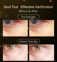 Crema reafirmante antihinchazón para eliminación de gránulos de grasa, crema antiinflamatoria que se desvanece, línea fina, reparación de barrera de la piel, cuidado de la piel coreano - details 7