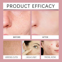 Almohadillas de Gel de Colágeno WEST MONTH Hidratación Profunda, Comodidad, Mejora de Elasticidad y Firmación de la Piel Herramientas de Cuidado de la Piel Facial - details 6