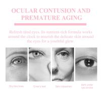 Crema para los Ojos de Retinol Anti-arrugas, Reducción de Hinchazón, Adiós a las Ojeras, Blanqueamiento de Piel, Hidratación Herramientas de Cuidado de la Piel Facial - details 6