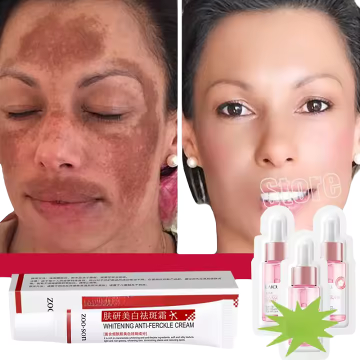Potente crema blanqueadora que elimina manchas, ilumina la piel, elimina rápidamente la pigmentación de melanina, melasma, manchas oscuras, cuidado de la piel coreano - 1