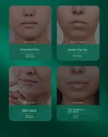 Vende adelgazante, estiramiento v-facial, pliegues nasolabiales, papada para mejorar el sueño, mascarilla de grabado facial, lifting - details 7