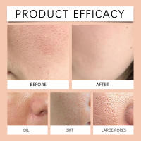 Esencia hidratante elástica para el cuidado de la piel nocturna Facial hidratante suave - details 11