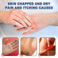 Urea Hidratante Pies, nutre y suaviza, mejora la sequedad, hidrata, cuidado de los pies - details 7