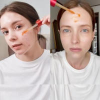 Medicube Exfoliante con ácido al 21 % (AHA+BHA+ácido succínico), suero retexturizante lavable, ideal para pieles con baches y propensas a las apariciones de espinillas, coreano - details 5
