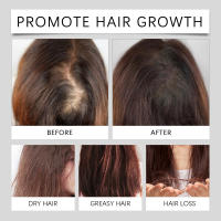 Solución de esencia para el cuidado del masaje diario del cuero cabelludo nutritivo para endurecer el cabello - details 7