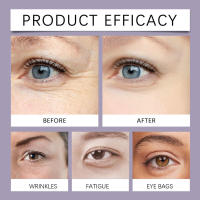 La crema para ojos con veneno de abeja es una crema suave, hidratante y suave para el cuidado de la piel. - details 11