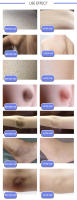 Crema blanqueadora corporal, blanqueador rápido, partes privadas, aclara las axilas, piernas, rodillas, melanina, áreas íntimas, elimina las manchas, belleza y salud - details 10