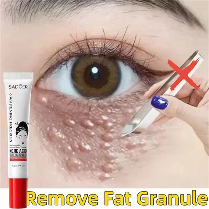Crema para los Ojos Anti-Hinchazón Reductor de Granos de Grasa Crema Firmadora Reductora de Ojeras - 1