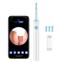 Otoscopio Visual para limpieza de oídos, limpiador de oídos inteligente inalámbrico con WiFi, herramienta de eliminación de cera de oído con cámara de 3,9mm, endoscopio - details 9