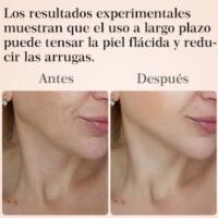 reducir las arrugas