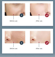 PULVERIZADOR frío para cuidado de la piel, máquina de belleza con luz Led, máscara Facial, Spa, terapia Pdt, rejuvenecimiento de la piel, eliminador de acné, 7 colores - details 10