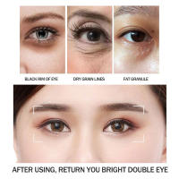 Crema para ojos eliminadora de gránulos de grasa, elimina las ojeras, bolsas para los ojos, desvanece las líneas finas, antihinchazón, arrugas, levanta el cuidado de la piel de los ojos reafirmante - details 5