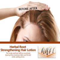 Loción de raíz de hierbas que fija la línea densa, repara, endurece, hidrata y previene la caída del cabello - details 6