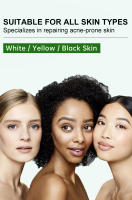 Crema Facial a base de hierbas para el acné, eliminación de marcas de espinillas, Control de aceite, crema hidratante para el rostro, cremas faciales suaves, productos para el cuidado de la piel JoyPretty - details 5