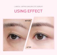 LAIKOU Sakura Ojo Serum Masajeador de Ojos Hidratante con Ácido Hialurónico Adiós a las Ojeras - details 8