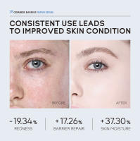 7X suero calmante para enrojecimiento Facial, tratamiento instantáneo de rosácea, venas de sangre rojas, mejora la reparación de la barrera de la piel sensible, cosméticos Coreanos - details 12